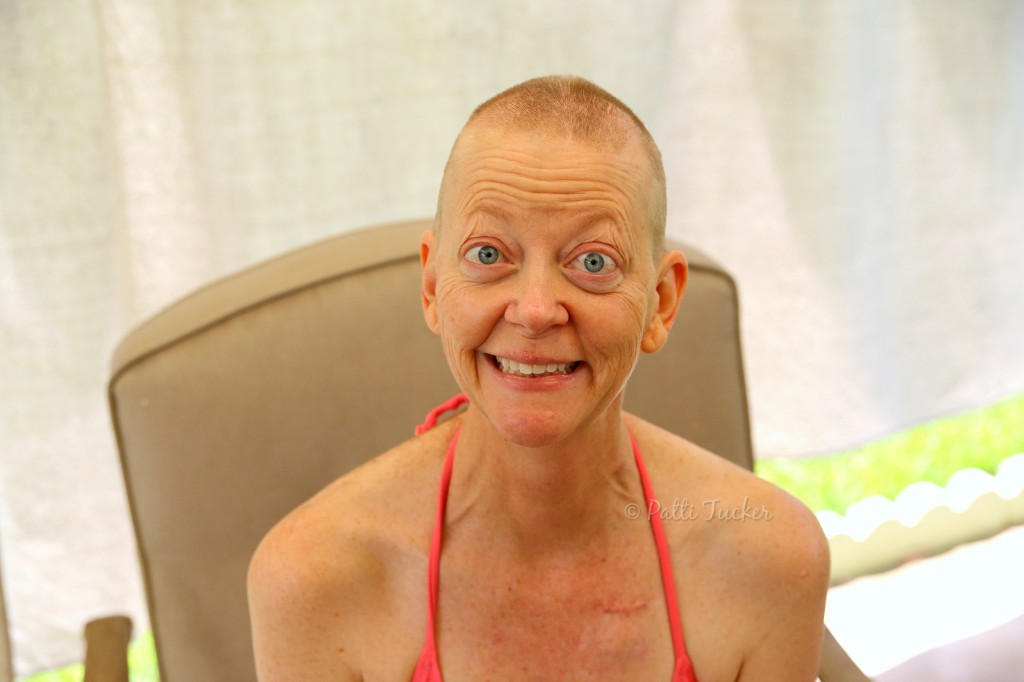 Woman outdoors sitting in chair in a bikini top witha shaved head because of cancer