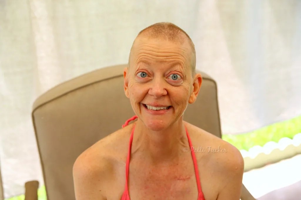 Woman outdoors sitting in chair in a bikini top witha shaved head because of cancer