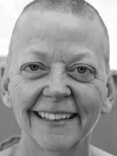 smiling woman with bald head